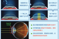 孩子近视怎么办？延缓度数加深！这种眼镜白天不用戴！缩略图